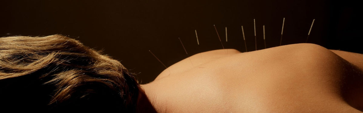 Acupuncture + Energy Healing